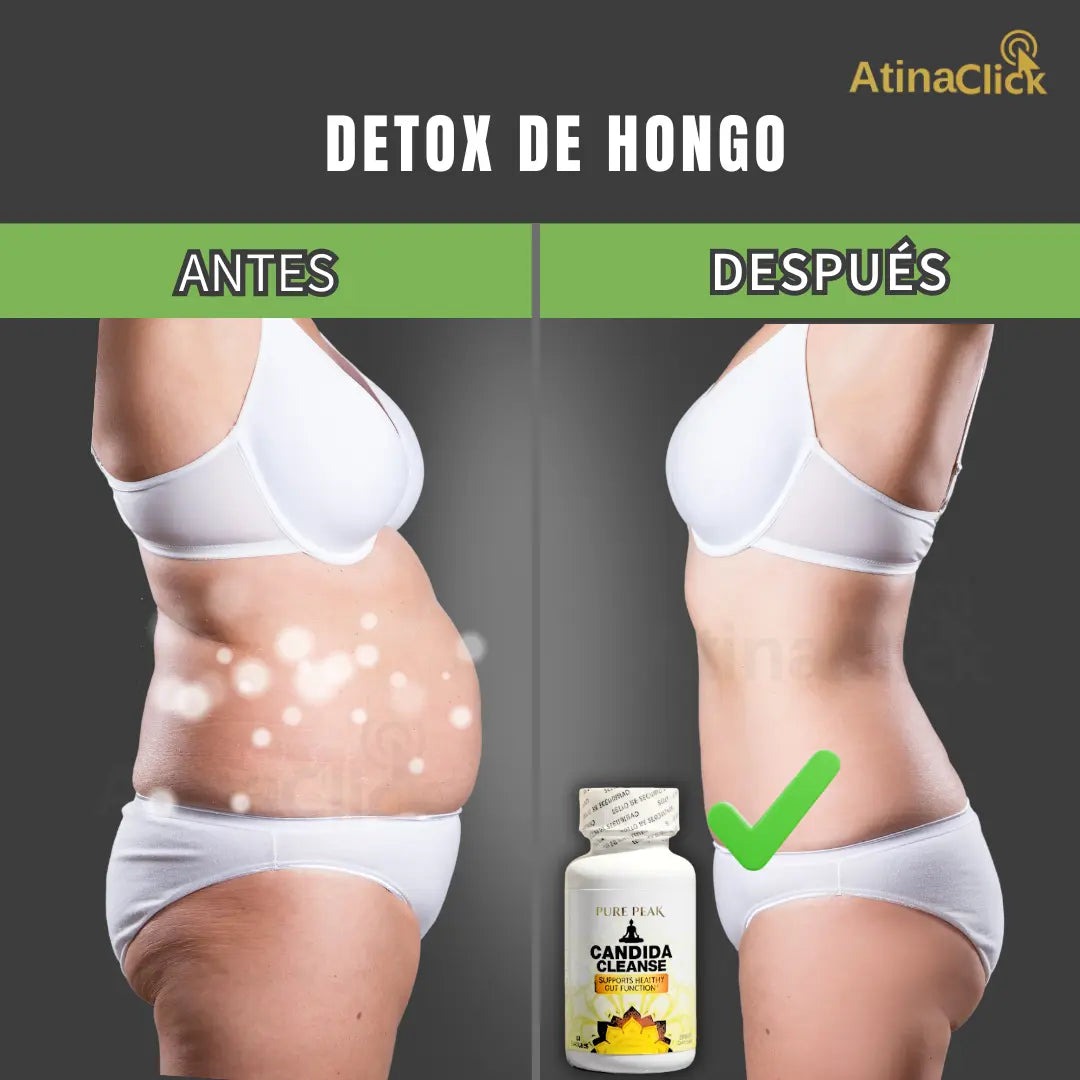 Détox Natural Candida Cleanse